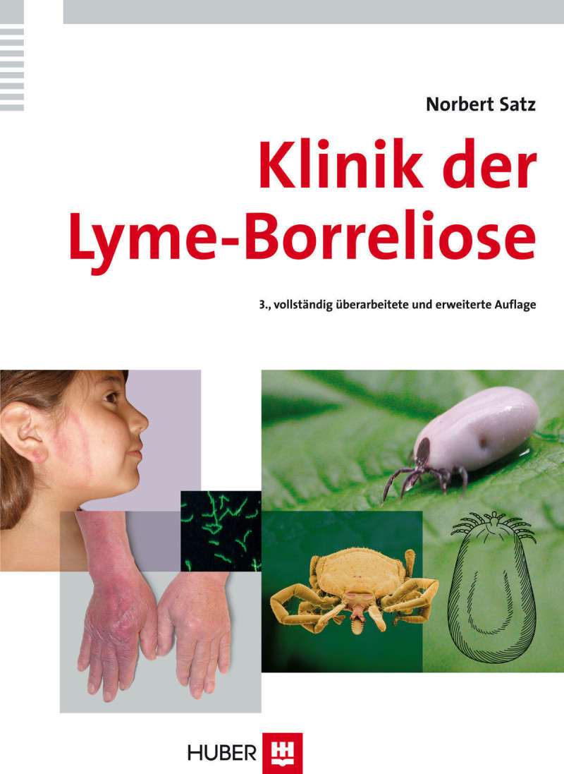 Klinik der LymeBorreliose Hogrefe Verlag