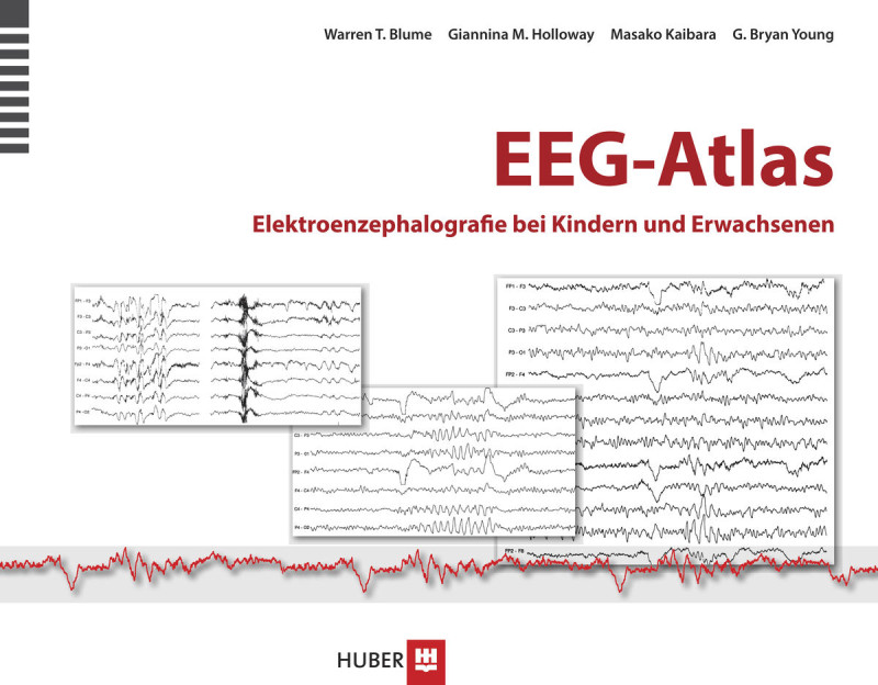 EEG-Atlas